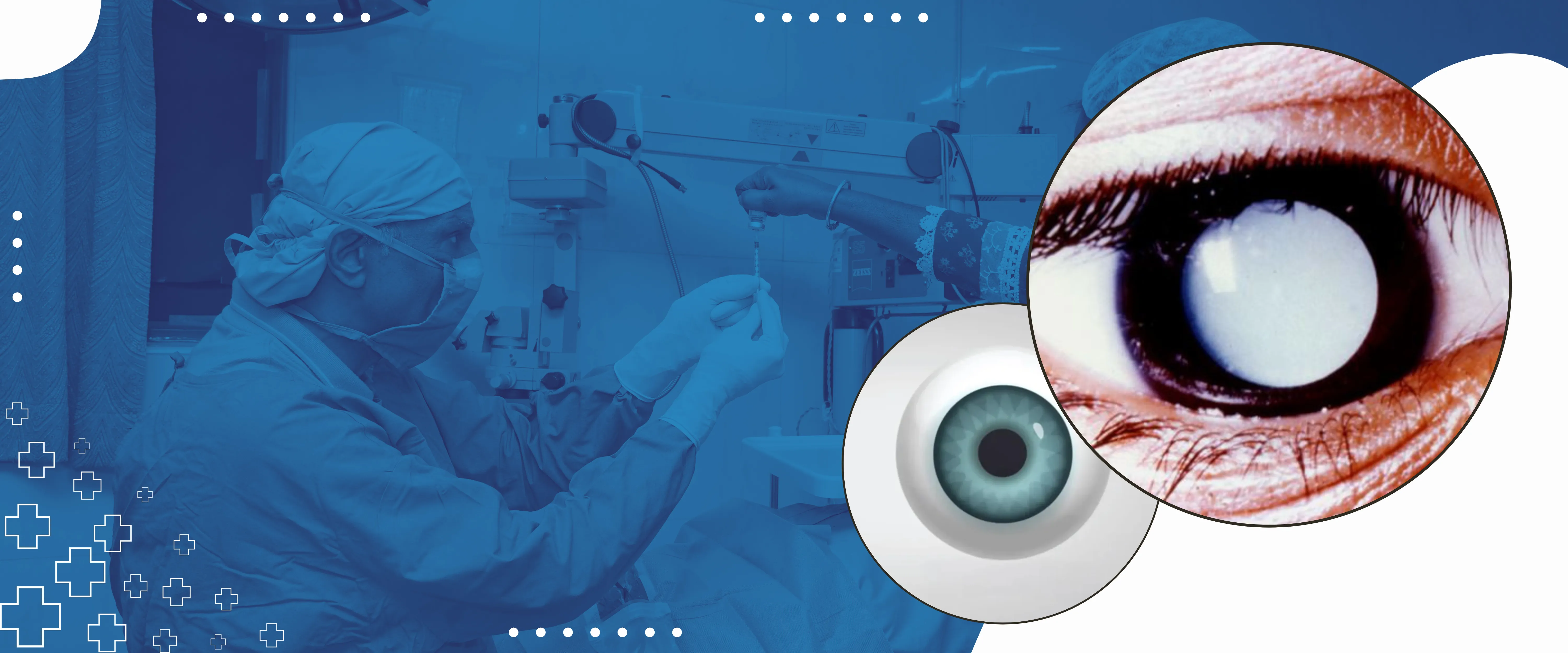 Cataract-Surgery