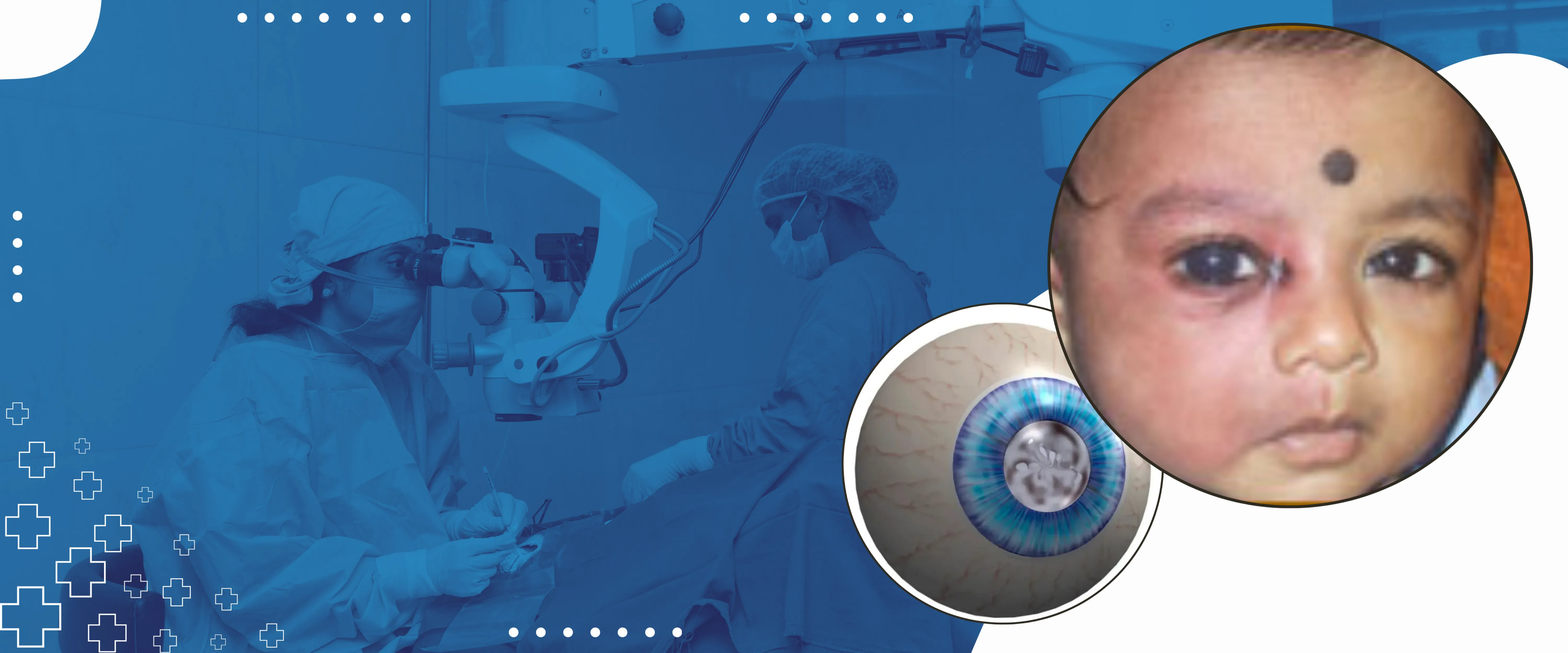 Glaucoma-Management