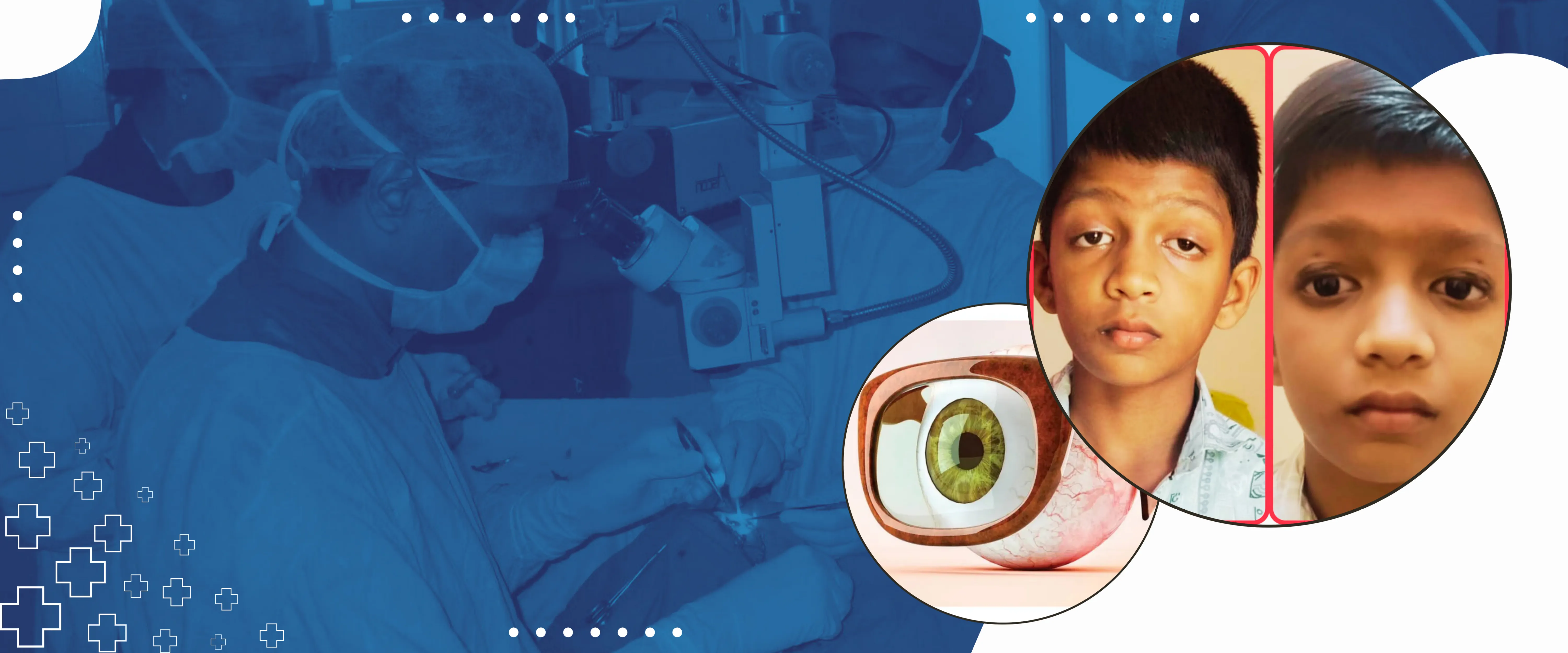 Oculoplasty